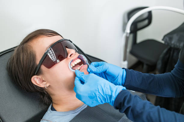 Best Chipped Tooth Repair Near Me  in Cleveland Heights, OH